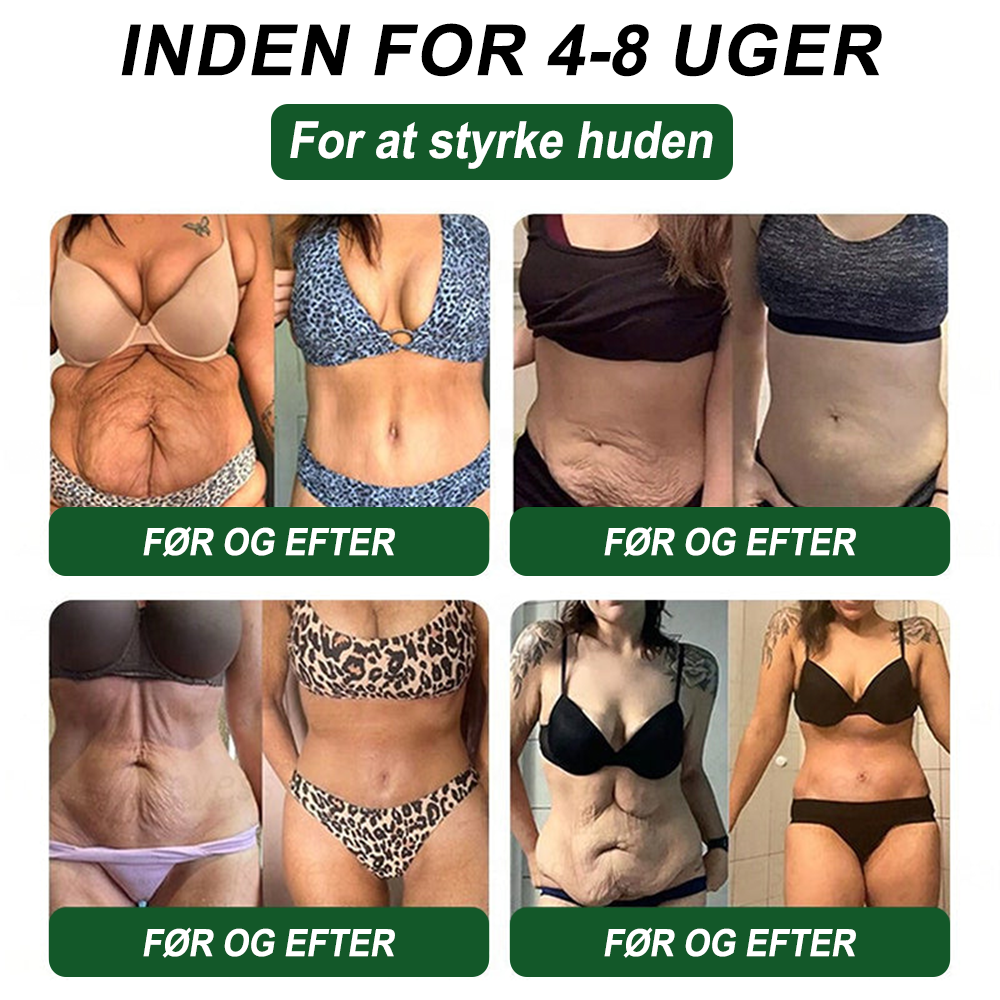 🇩🇰Online butik🌲𝑆𝑇𝐷𝐸𝐼® NAD+ GLP-1 Fit & Vital Oralopløsning (1× dagligt) ✅ Velegnet til overvægt, hjerte-kar-sundhed, diabetes, søvnapnø, tarmhelse, ledsproblemer og andre sundhedsbehov