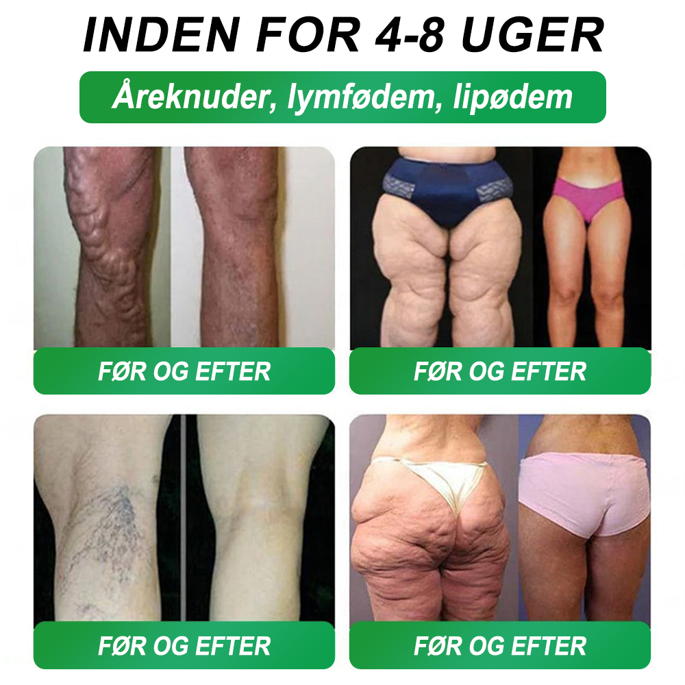 🇩🇰Online butik🌲𝑆𝑇𝐷𝐸𝐼® NAD+ GLP-1 Fit & Vital Oralopløsning (1× dagligt) ✅ Velegnet til overvægt, hjerte-kar-sundhed, diabetes, søvnapnø, tarmhelse, ledsproblemer og andre sundhedsbehov