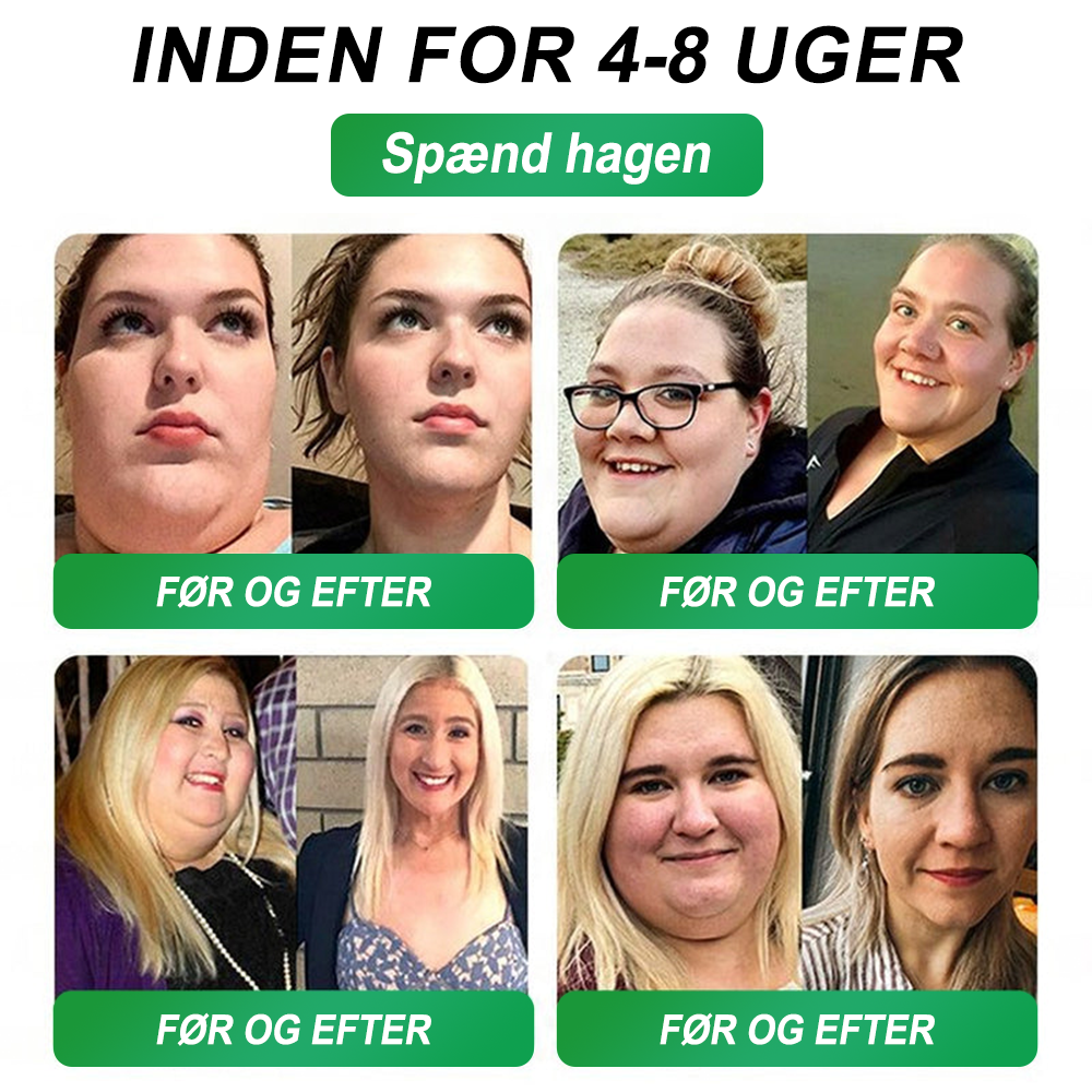 🇩🇰Online butik🌲𝑆𝑇𝐷𝐸𝐼® NAD+ GLP-1 Fit & Vital Oralopløsning (1× dagligt) ✅ Velegnet til overvægt, hjerte-kar-sundhed, diabetes, søvnapnø, tarmhelse, ledsproblemer og andre sundhedsbehov