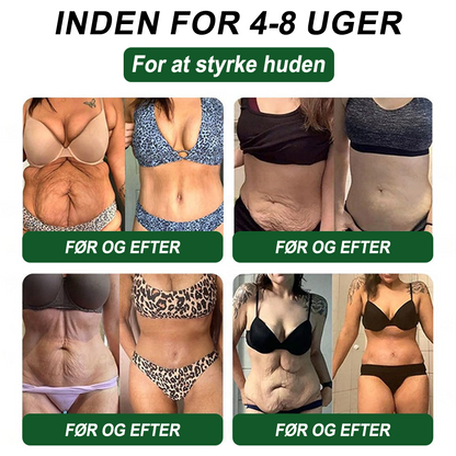🇩🇰Online butik🌲𝑆𝑇𝐷𝐸𝐼® NAD+ GLP-1 Fit & Vital Oralopløsning (1× dagligt) ✅ Velegnet til overvægt, hjerte-kar-sundhed, diabetes, søvnapnø, tarmhelse, ledsproblemer og andre sundhedsbehov